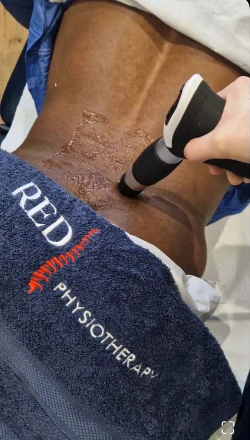 Advanced shockwave therapy treatment being administered to accelerate healing and reduce chronic pain in patients